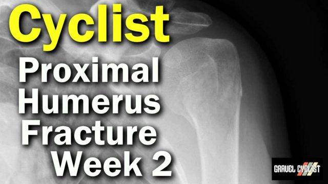 proximal humerus fracture cyclist