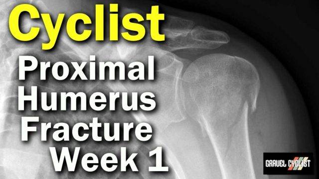 proximal humerus fracture cyclist